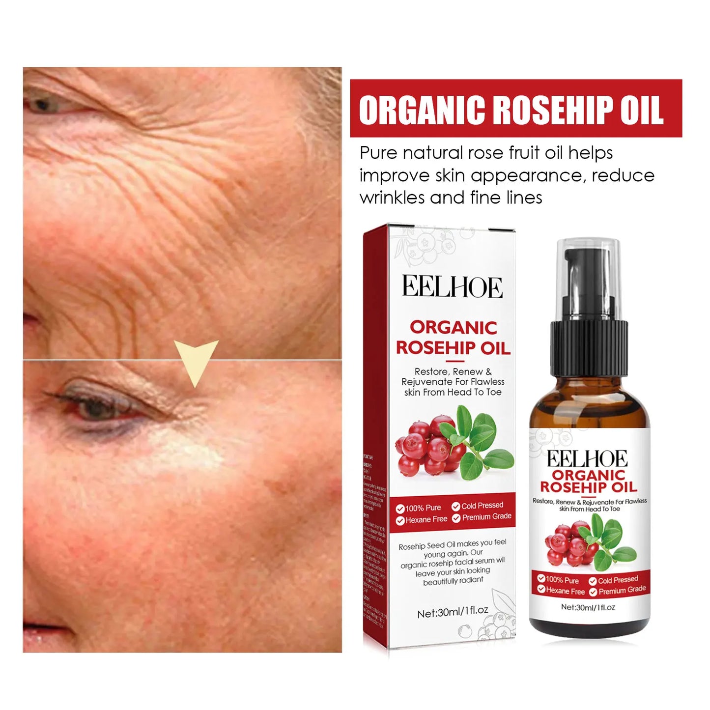 EELHOE Rosehip Serum-3